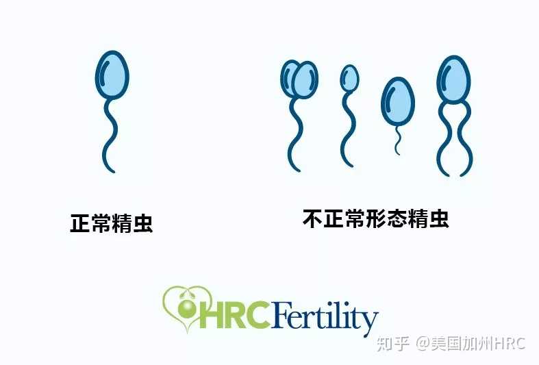 hiv洗精可以做试管婴儿吗,珠海恒生医院供卵做三代试管婴儿要等多久？,HRC课堂