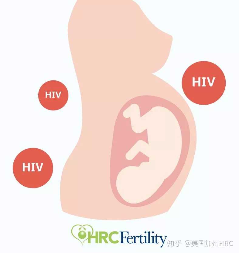 hiv感染者可以做试管婴儿吗女性,HRC课堂|HIV感染也可以健康生育？！辅助生殖技